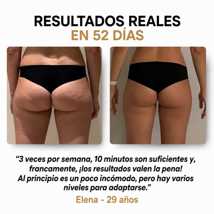 Masajeador Anticelulítico con Ventosa