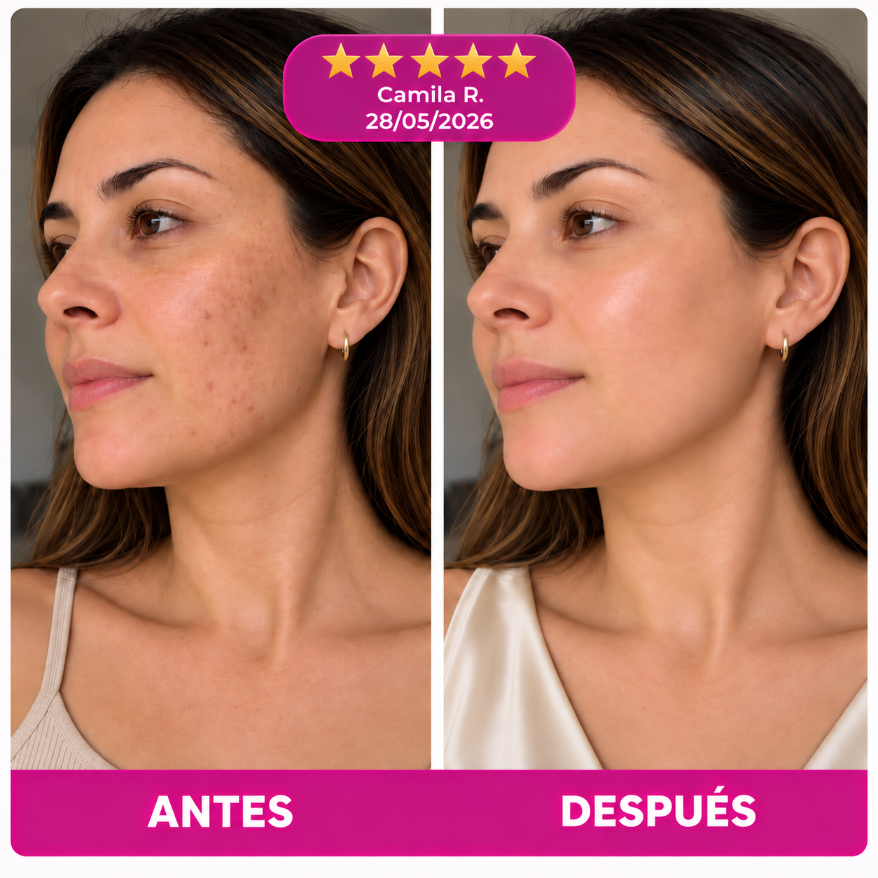 Crema Facial Antimanchas
