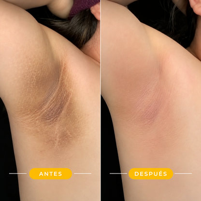 Crema Aclaradora de Manchas