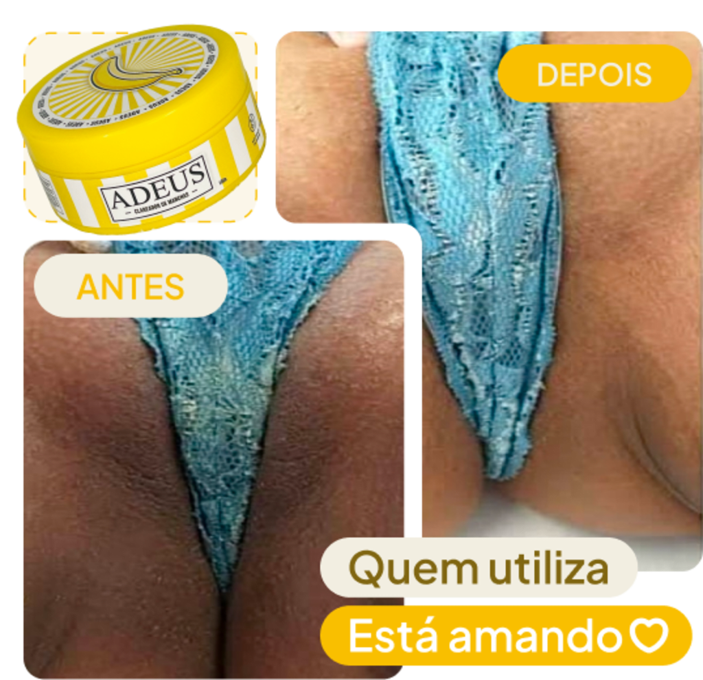 Creme Adeus Clareador de Manchas 100g